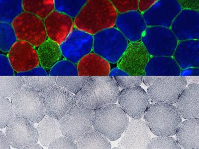Cover image for research topic "Mitochondria in Skeletal Muscle Health, Aging and Diseases"