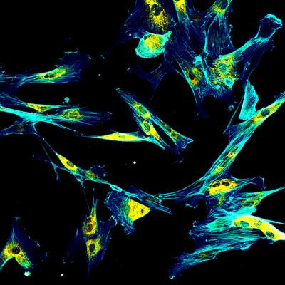Cover image for research topic "The Cardiac Stroma in Homeostasis and Disease"