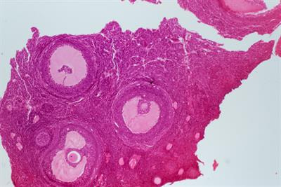 Cover image for research topic "Update on Hypogonadism in Turner Syndrome"