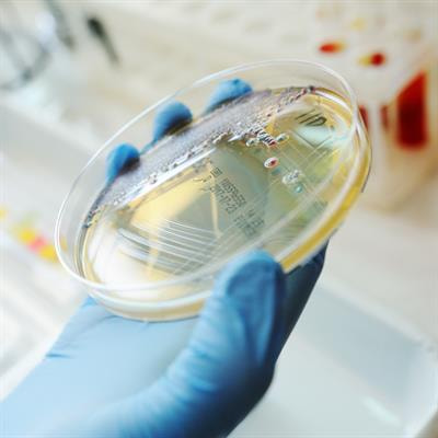 Cover image for research topic "Non-Genetic Memory in Microorganisms"