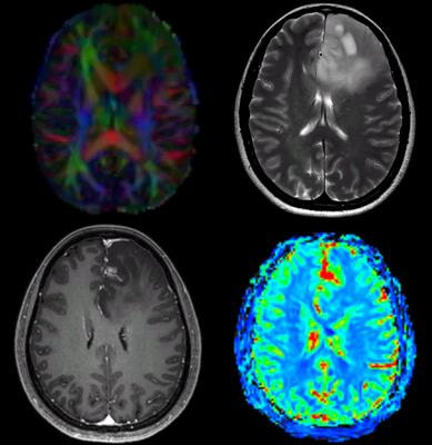 Cover image for research topic "New Challenges and Future Perspectives in Brain Imaging Methods"