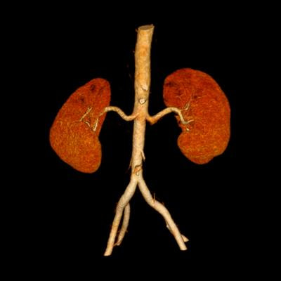 Cover image for research topic "Critical Care Nephrology: A Multiorgan Subspecialty in the ICU"