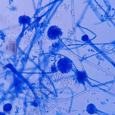 Cover image for research topic "Aspergillus-Derived Mycotoxins In The Feed And Food Chain, Volume II"