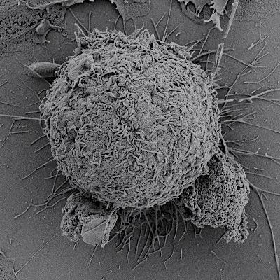 Cover image for research topic "MAIT Cells Come of Age"
