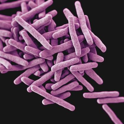 Cover image for research topic "Immunology of Tuberculosis"