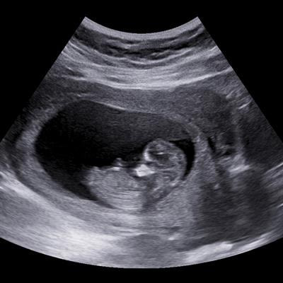 Cover image for research topic "Nutrient Supplementation and its Impact on Pregnancy Outcomes"
