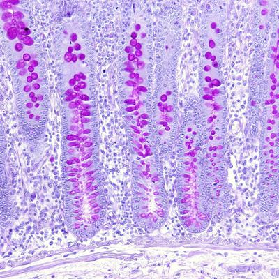 Cover image for research topic "Heterogeneity in Cells: Identification of Markers and Functional Differences"