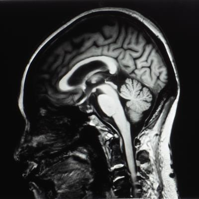 Cover image for research topic "Cancer Neuroscience: Drug Repurposing Targeting Innervated Niche"