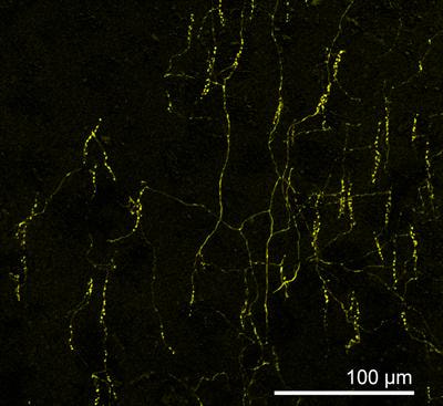 Cover image for research topic "Inhibitory Cortical Interneurons: From Microcircuits to Behavior"