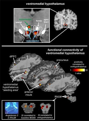 Cover image for research topic "Neuroimaging of Human Autonomic Control"