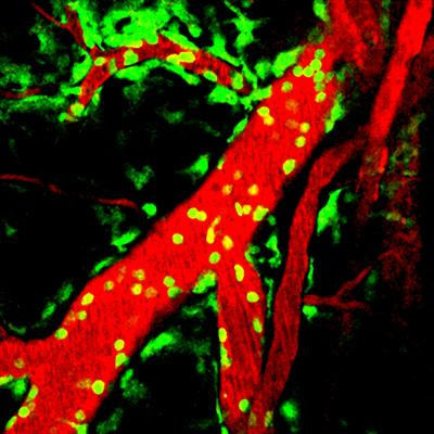Cover image for research topic "Inflammation in the CNS: Advancing the field using intravital imaging"