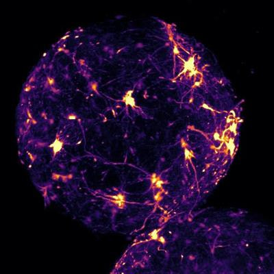 Cover image for research topic "Advances and Challenges in Studying Brain Disorders: from Development to Aging"