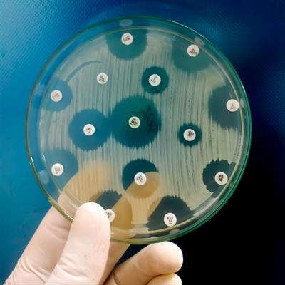 Cover image for research topic "Plant-Based Antimicrobials and Their Role in Food Safety"