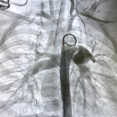 Cover image for research topic "Case Reports in Structural Interventional Cardiology: 2022"
