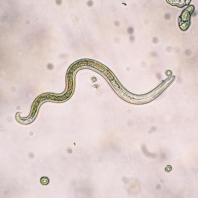 Cover image for research topic "Soil-Transmitted Helminth Infections from a One Health Perspective"