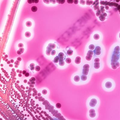 Cover image for research topic "Intracellular Bacterial Pathogens: Infection, Immunity and Interventions"