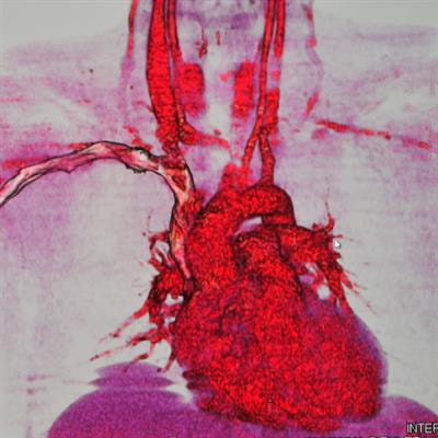 Cover image for research topic "Transcription Factors in Cardiovascular Development and Remodeling"