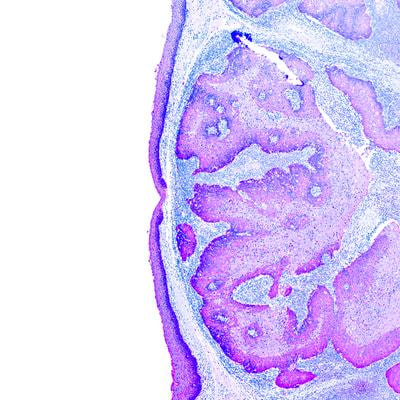 Cover image for research topic "Recent Advances in the Treatment of Upper Urinary Tract and Bladder Cancers"