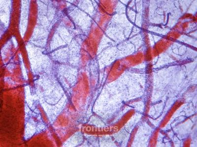 Cover image for research topic "Epigenetic Mechanisms and Epigenetic Based Therapies in Cardiometabolic and Vascular Disease"