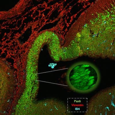 Cover image for research topic "Transcription Regulation - Brain Development and Homeostasis - A Finely Tuned and Orchestrated Scenario in Physiology and Pathology, volume II"