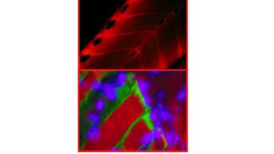 Cover image for research topic "Muscle-Tendon-Innervation Unit: degeneration and aging - pathophysiological and regeneration mechanisms"