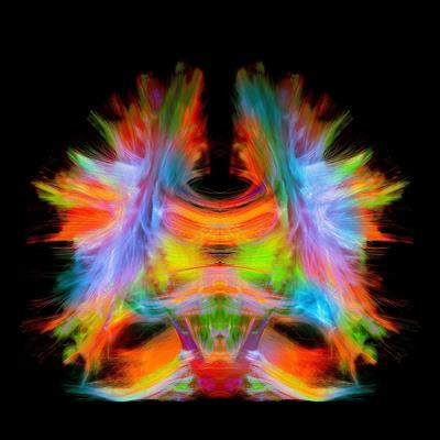 Cover image for research topic "UN World Creativity and Innovation Day:  Creativity in Brain Health and Neuroscience of Creativity"
