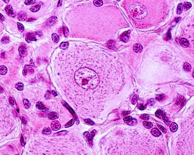 Cover image for research topic "Transcriptional Changes in the Dorsal Root Ganglia"