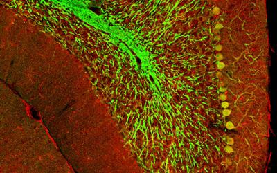 Cover image for research topic "The Molecular Mechanisms and Potential Drug Targets for Remyelination and Neuroregeneration"