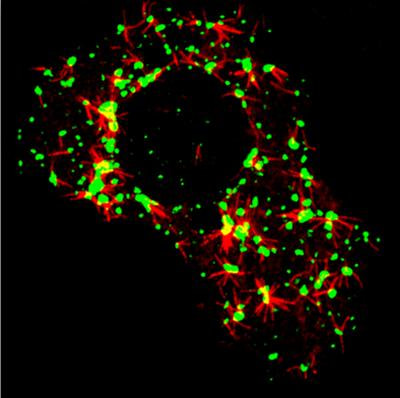 Cover image for research topic "Golgi Pathology in Neurodegenerative Diseases"