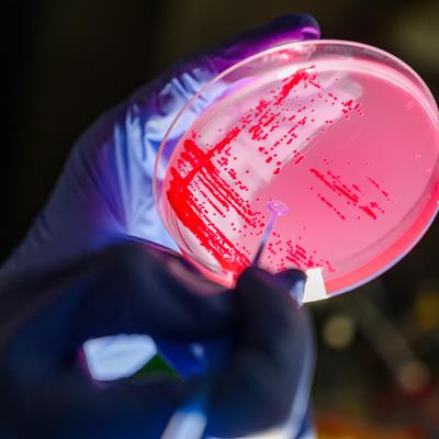 Cover image for research topic "Evolution and Role in Disease of Bacterial Populations From an Omics Perspective and Succession of Species"