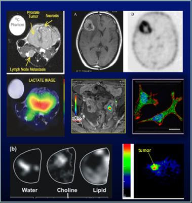 Cover image for research topic "Exploring cancer metabolic reprogramming through molecular imaging"