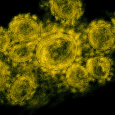 Cover image for research topic "COVID-19: From Bedside to Follow-up"