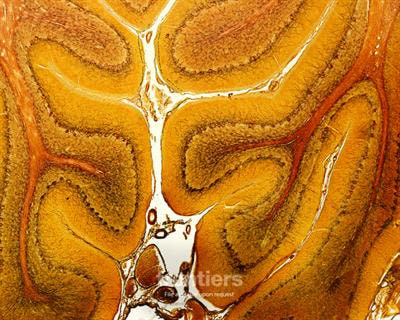 Cover image for research topic "Advances in Cortical Microstructural Imaging and Application in Neurodegeneration and Neurodevelopmental Disorders"