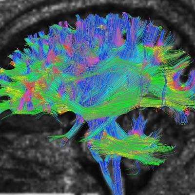 Cover image for research topic "Recent Developments in Neuroimaging in Mood Disorders"