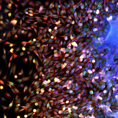 Cover image for research topic "Brain Cancer Pathogenesis and Data Integration"