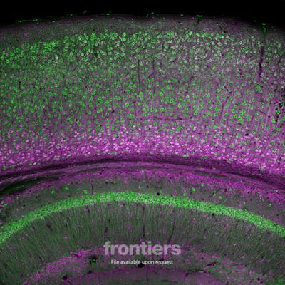 Cover image for research topic "Inhibitory Interneuron Classification, Function and Dysfunction in Neural Network"