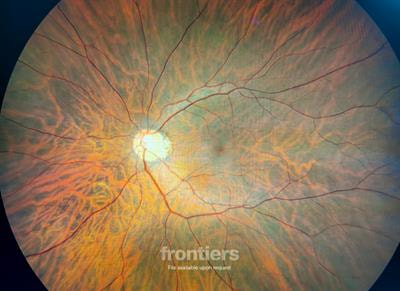 Cover image for research topic "Current Topics in Photoreceptor Biology"