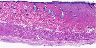 Cover image for research topic "On Tissue Engineering and Regenerative Medicine of Skin and Its Appendages"