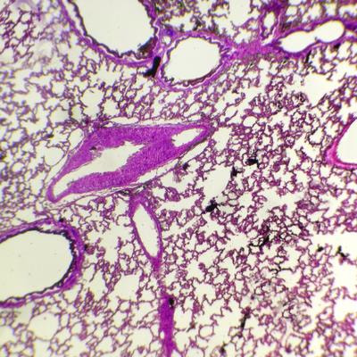 Cover image for research topic "Vascular Pathophysiology in Hypoxia"