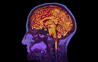 Cover image for research topic "The Digitalization of Neurology"