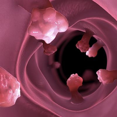 Cover image for research topic "Ferroptosis as a Novel Therapeutic Target for Inflammation-Related Diseases"