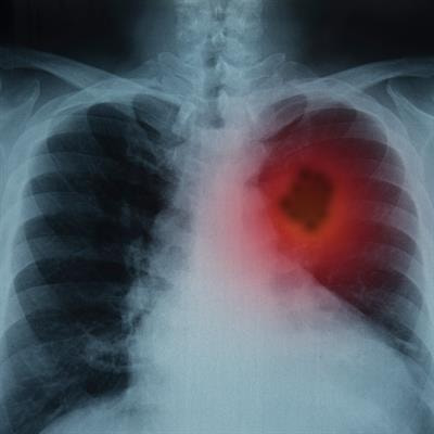 Cover image for research topic "Safety of Corticosteroids in Respiratory Medicine"