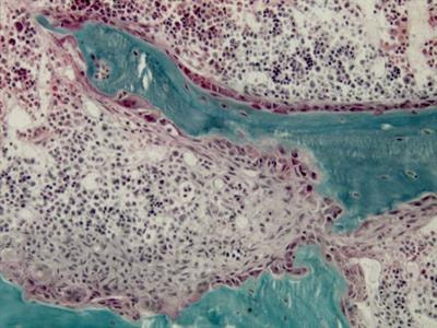 Cover image for research topic "Pathophysiology of Bone and Mineral Metabolism"