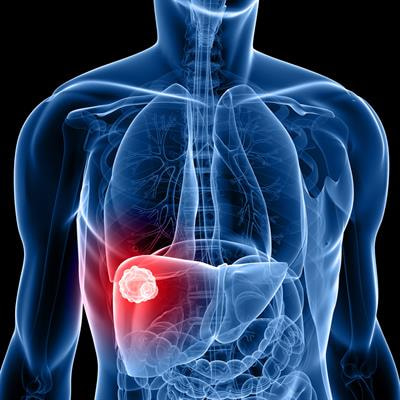 Cover image for research topic "Precision Medical Imaging for Cancer Diagnosis and Treatment"