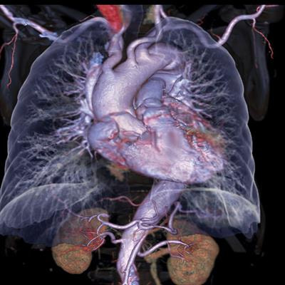 Cover image for research topic "Myocarditis and Inflammatory Cardiomyopathies: Diagnosis, treatment and future directions"