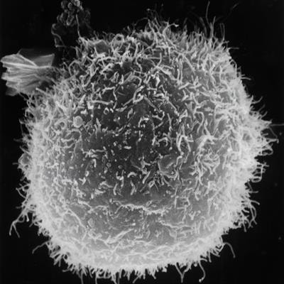 Cover image for research topic "Macrophage in Hepatology"