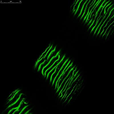 Cover image for research topic "Biomarkers in Structural Cardiovascular Disease: Insights into Screening, Diagnosis and Prognosis"