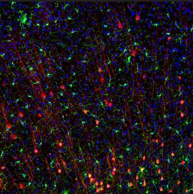 Cover image for research topic "The Neuroendocrine, Autonomic and Neuroinflammatory Stress Axes in Cardiometabolic Disease"