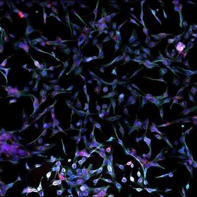 Cover image for research topic "Phasor Analysis for fluorescence lifetime data"