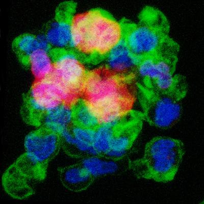 Cover image for research topic "NETosis 2: the excitement continues"